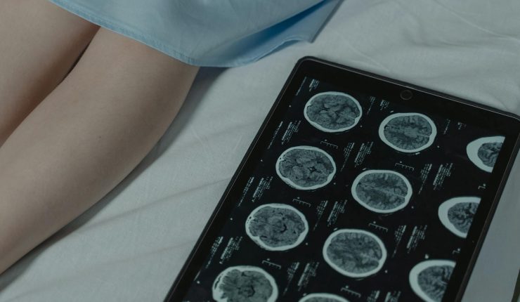 pexels tima miroshnichenko 6011611 740x430 1