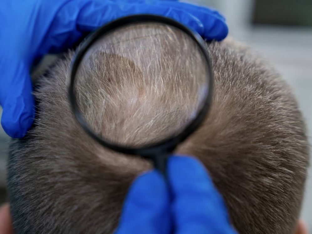 f.elconfidencial.com original 06a a44 864 06aa44864f6be67542eb5b73369884ca