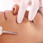 dermaplaning